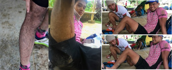 Although I did get some souvenirs; Thanks RL for the medical assistance!